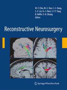 Chiu / Chiang / Kao | Reconstructive Neurosurgery | E-Book | www.sack.de