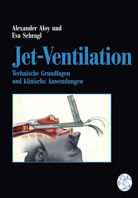 Schragl / Aloy |  Jet-Ventilation | Buch |  Sack Fachmedien