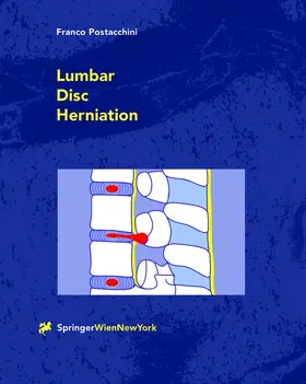Postacchini | Lumbar Disc Herniation | Buch | 978-3-211-83118-2 | www.sack.de