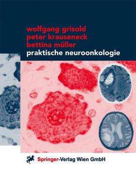 Grisold / Müller / Krauseneck | Praktische Neuroonkologie | Buch | 978-3-211-83247-9 | sack.de