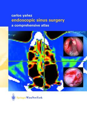 Yañez | Endoscopic Sinus Surgery | Buch | 978-3-211-83712-2 | sack.de