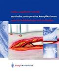Bühler / Schmidt / Engelhardt |  Septische postoperative Komplikationen | Buch |  Sack Fachmedien