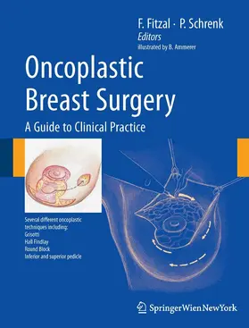 Fitzal / Schrenk |  Oncoplastic Breast Surgery | eBook | Sack Fachmedien