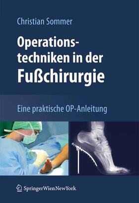 Sommer | Operationstechniken in der Fußchirurgie | E-Book | sack.de