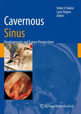 Rogers / Dolenc |  Cavernous Sinus | Buch |  Sack Fachmedien