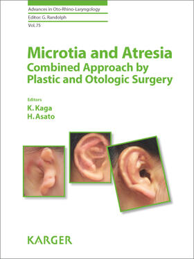 Kaga / Asato | Microtia and Atresia - Combined Approach by Plastic and Otologic Surgery | E-Book | sack.de