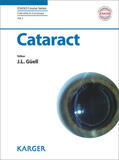 Güell |  Cataract | eBook | Sack Fachmedien