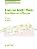 Lussi / Ganss |  Erosive Tooth Wear | eBook | Sack Fachmedien