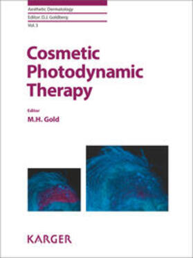 Gold |  Cosmetic Photodynamic Therapy | Buch |  Sack Fachmedien