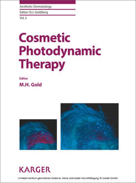Gold |  Cosmetic Photodynamic Therapy | eBook | Sack Fachmedien