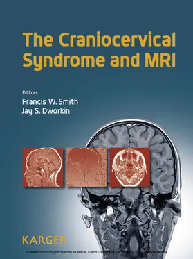 Smith / Dworkin | The Craniocervical Syndrome and MRI | E-Book | www.sack.de