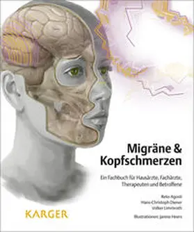 Agosti / Diener / Limmroth |  Migräne und Kopfschmerzen | Buch |  Sack Fachmedien