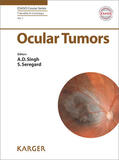Singh / Seregard |  Ocular Tumors | eBook | Sack Fachmedien