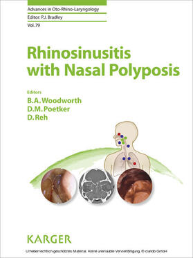 Woodworth / Poetker / Reh |  Rhinosinusitis with Nasal Polyposis | eBook | Sack Fachmedien