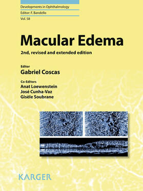 Coscas / Loewenstein / Cunha-Vaz | Macular Edema | E-Book | sack.de