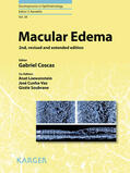 Coscas / Loewenstein / Cunha-Vaz |  Macular Edema | eBook | Sack Fachmedien