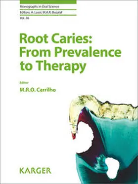 Rocha de Olivera Carrilho |  Root Caries: From Prevalence to Therapy | Buch |  Sack Fachmedien