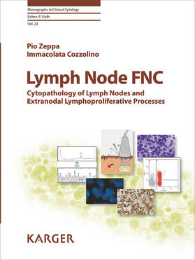 Zeppa / Cozzolino / Vielh | Lymph Node FNC | E-Book | sack.de