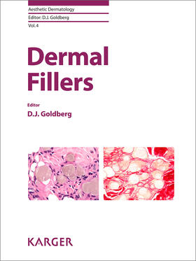 Goldberg |  Dermal Fillers | eBook | Sack Fachmedien