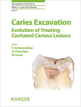 Schwendicke / Frencken / Innes | Caries Excavation: Evolution of Treating Cavitated Carious Lesions | E-Book | www.sack.de