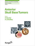 Nicolai / Bradley |  Anterior Skull Base Tumors | Buch |  Sack Fachmedien