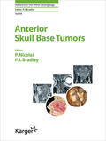 Nicolai / Bradley |  Anterior Skull Base Tumors | eBook | Sack Fachmedien