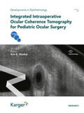 Nischal |  Integrated Intraoperative Ocular Coherence Tomography for Pediatric Ocular Surgery | Buch |  Sack Fachmedien
