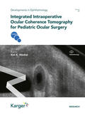 Nischal |  Integrated Intraoperative Ocular Coherence Tomography for Pediatric Ocular Surgery | eBook | Sack Fachmedien