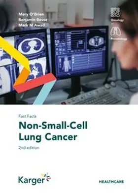 O'Brien / Besse / Awad |  Fast Facts: Non-Small-Cell Lung Cancer | Buch |  Sack Fachmedien