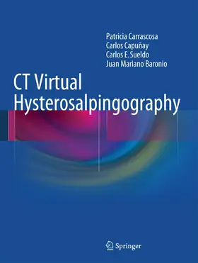 Carrascosa / Baronio / Capuñay |  CT Virtual Hysterosalpingography | Buch |  Sack Fachmedien