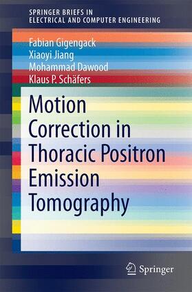 Gigengack / Schäfers / Jiang |  Motion Correction in Thoracic Positron Emission Tomography | Buch |  Sack Fachmedien