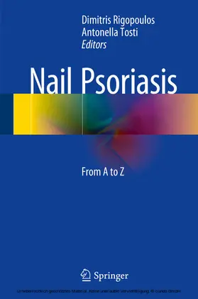 Rigopoulos / Tosti |  Nail Psoriasis | eBook | Sack Fachmedien