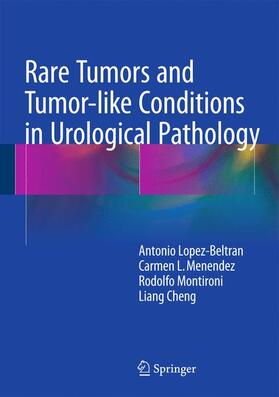 Lopez-Beltran / Cheng / Menendez | Rare Tumors and Tumor-like Conditions in Urological Pathology | Buch | 978-3-319-10252-8 | sack.de