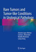 Lopez-Beltran / Menendez / Montironi |  Rare Tumors and Tumor-like Conditions in Urological Pathology | eBook | Sack Fachmedien
