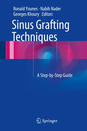 Younes / Nader / Khoury | Sinus Grafting Techniques | E-Book | www.sack.de
