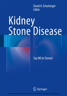 Schulsinger |  Kidney Stone Disease | eBook | Sack Fachmedien