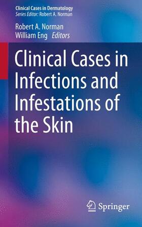 Norman / Eng | Norman, R: Clinical Cases in Infections and Infestations | Buch | 978-3-319-14294-4 | sack.de