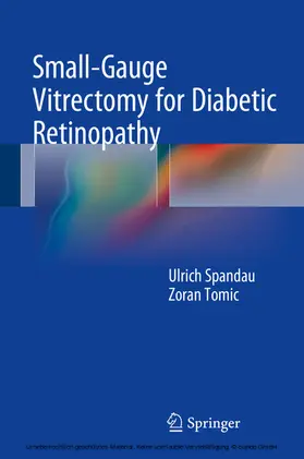 Spandau |  Small-Gauge Vitrectomy for Diabetic Retinopathy | eBook | Sack Fachmedien