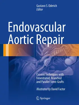 Oderich |  Endovascular Aortic Repair | Buch |  Sack Fachmedien