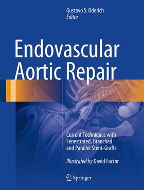 Oderich | Endovascular Aortic Repair | Buch | 978-3-319-15191-5 | sack.de