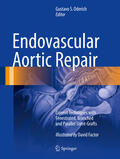 Oderich |  Endovascular Aortic Repair | eBook | Sack Fachmedien