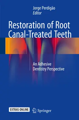 Perdigão |  Restoration of Root Canal-Treated Teeth | eBook | Sack Fachmedien