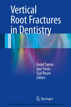 Tamse / Tsesis / Rosen | Vertical Root Fractures in Dentistry | E-Book | sack.de