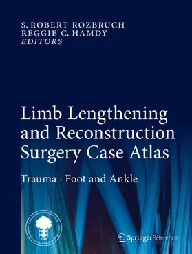 Hamdy / Rozbruch |  Limb Lengthening and Reconstruction Surgery Case Atlas | Buch |  Sack Fachmedien