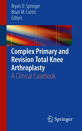 Springer / Curtin |  Complex Primary and Revision Total Knee Arthroplasty | Buch |  Sack Fachmedien