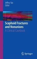 Yao |  Scaphoid Fractures and Nonunions | Buch |  Sack Fachmedien