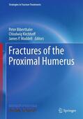 Biberthaler / Waddell / Kirchhoff |  Fractures of the Proximal Humerus | Buch |  Sack Fachmedien