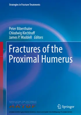 Biberthaler / Kirchhoff / Waddell |  Fractures of the Proximal Humerus | eBook | Sack Fachmedien