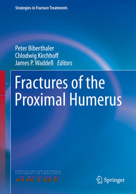 Biberthaler / Kirchhoff / Waddell | Fractures of the Proximal Humerus | E-Book | sack.de