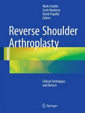 Frankle / Marberry / Pupello |  Reverse Shoulder Arthroplasty | Buch |  Sack Fachmedien